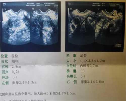 广州正规靠谱代孕网,流程来了！广州试管婴儿需要请假多久时间？_试管报销暂